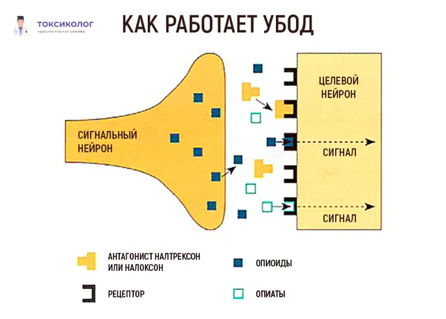 УБОД: современный метод детоксикации организма Медицинское оборудование для эффективного выполнения УБОД